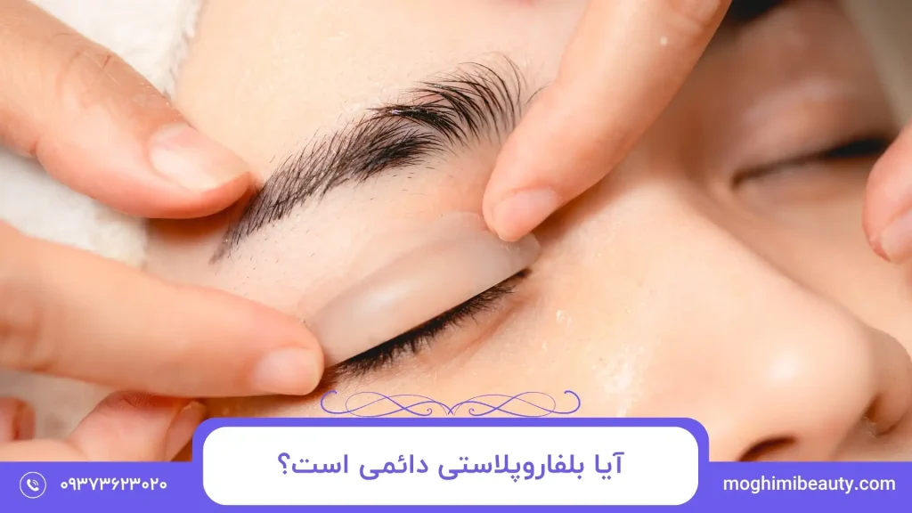 آیا بلفاروپلاستی دائمی است؟