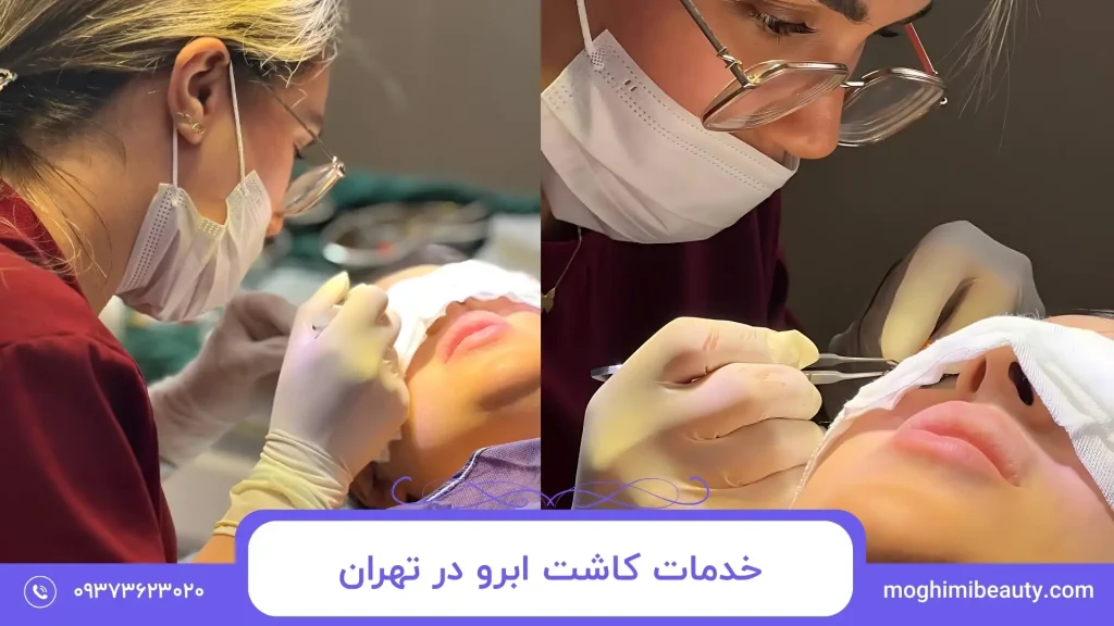خدمات کاشت ابرو در تهران
