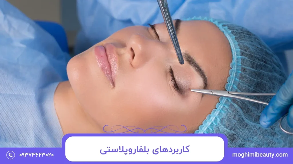 کاربردهای بلفاروپلاستی