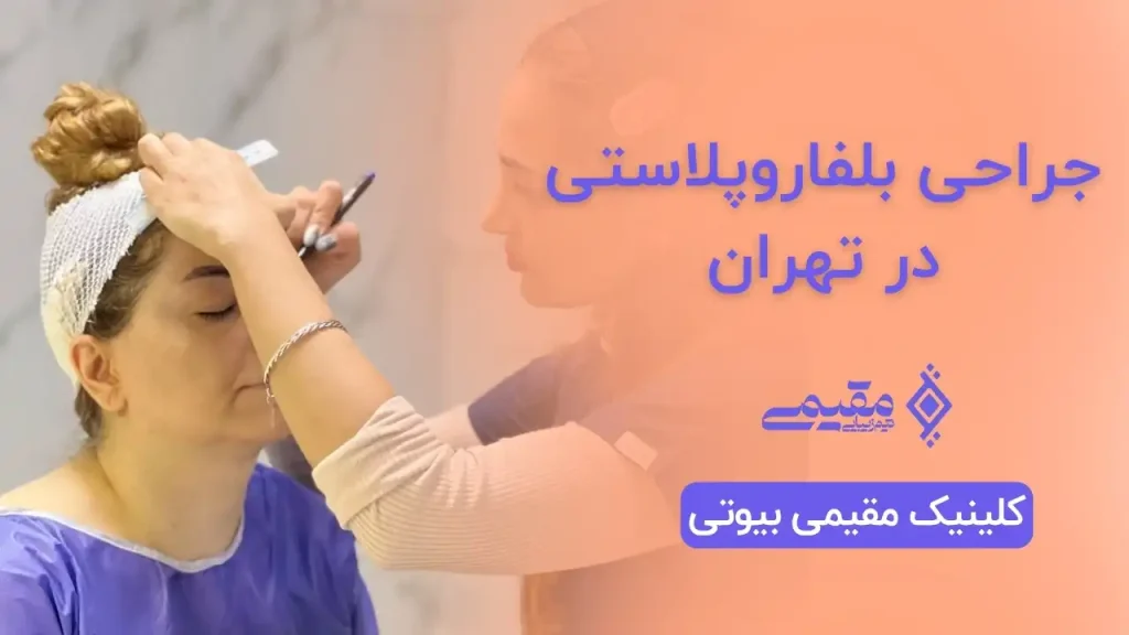 جراحی بلفاروپلاستی در تهران