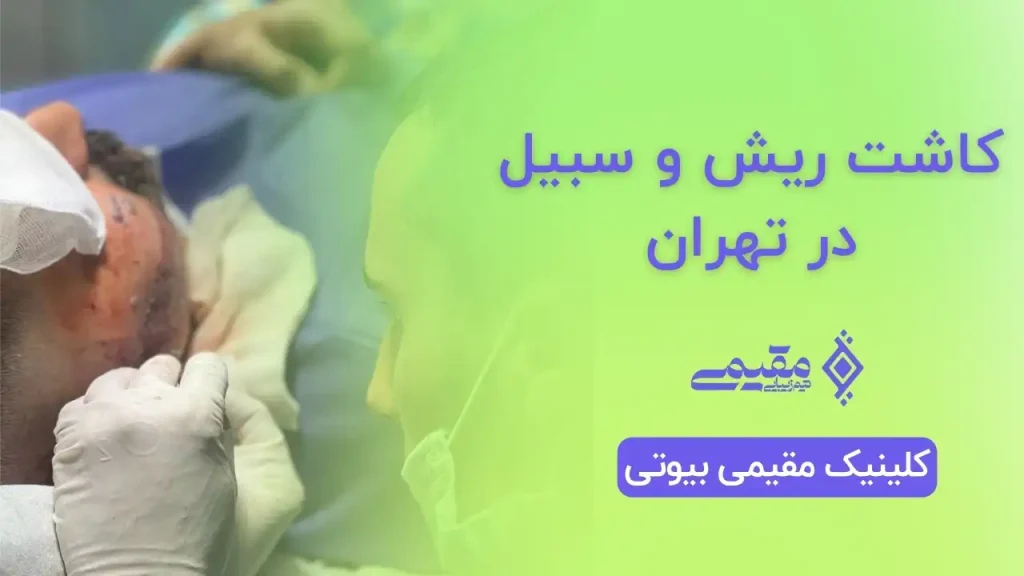 کاشت ریش و سبیل ارزان در تهران