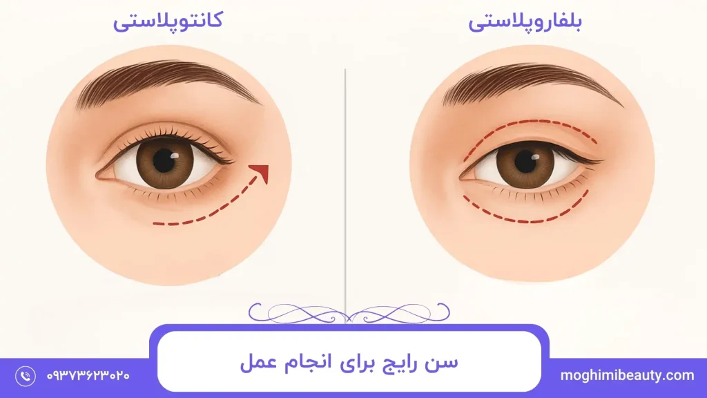 شباهت‌های کانتوپلاستی و بلفاروپلاستی چیست؟