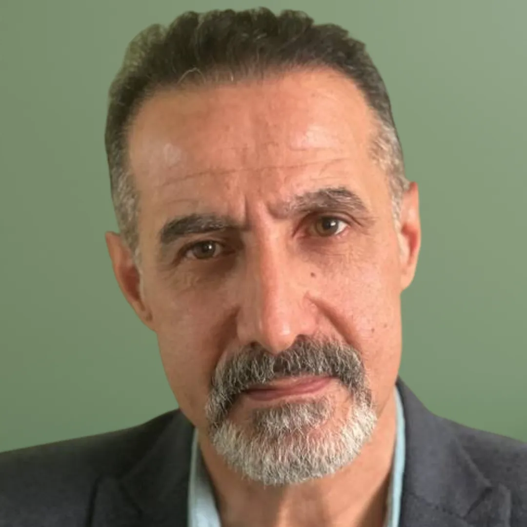 نمونه کاشت مو کلینیک مقیمی بیوتی 2.2