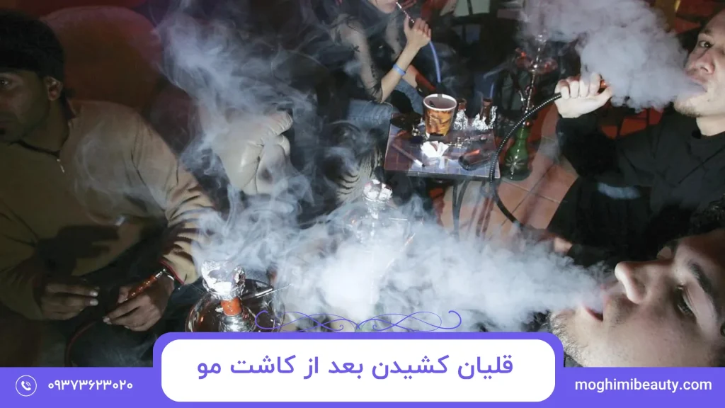 قلیان کشیدن بعد از کاشت مو