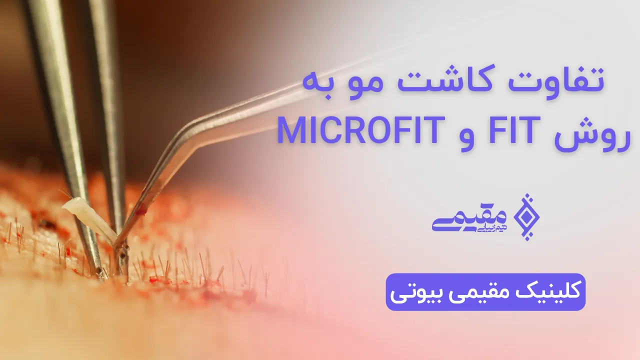 تفاوت کاشت مو به روش FIT و MicroFIT