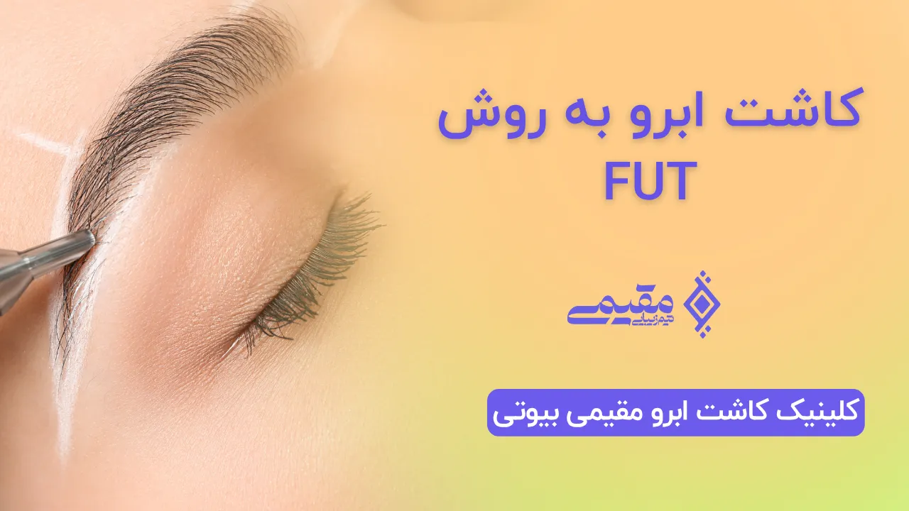 کاشت ابرو به روش FUT