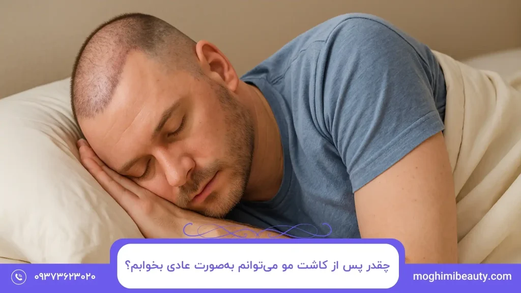 چقدر پس از کاشت مو می‌توانم به‌صورت عادی بخوابم؟