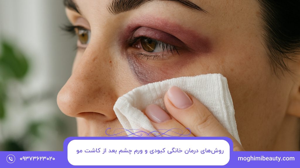روش‌های درمان خانگی کبودی و ورم چشم بعد از کاشت مو​