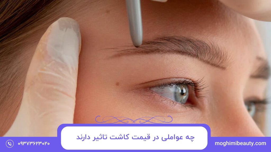 روش‌های درمان خانگی کبودی و ورم چشم بعد از کاشت مو​