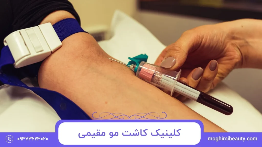 Moghimi Hair Transplant Clinic in tehran