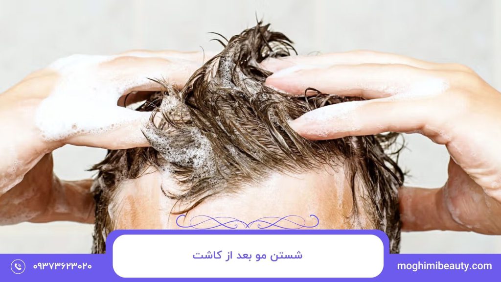 شستن مو بعد از کاشت