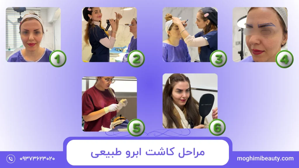 Natural eyebrow transplant steps