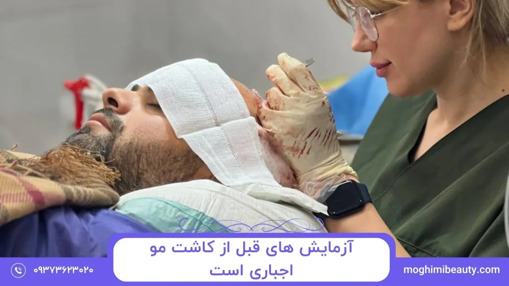 Pre-hair transplant tests are mandatory