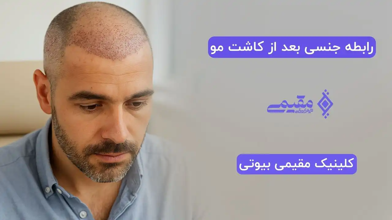 رابطه جنسی بعد از کاشت مو: همه نکات مهمی که باید بدانید