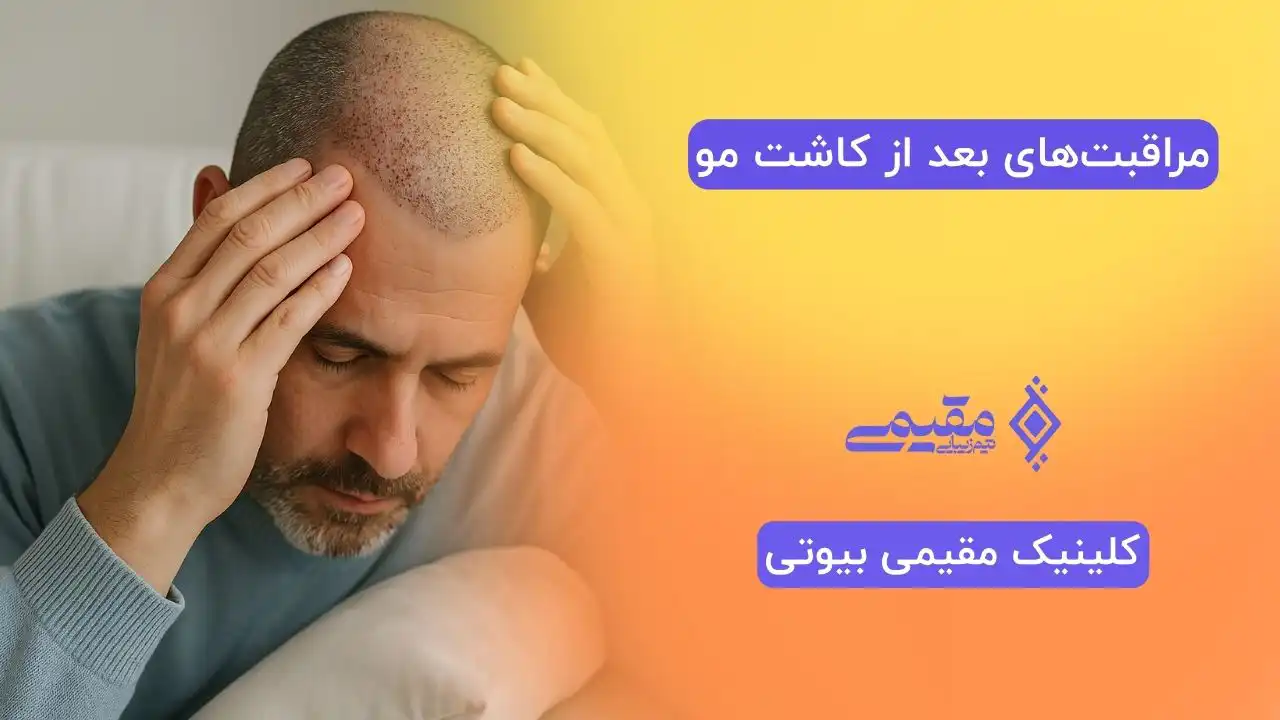 مراقبت‌های بعد از کاشت مو؛ راهنمای کامل برای بهترین نتیجه