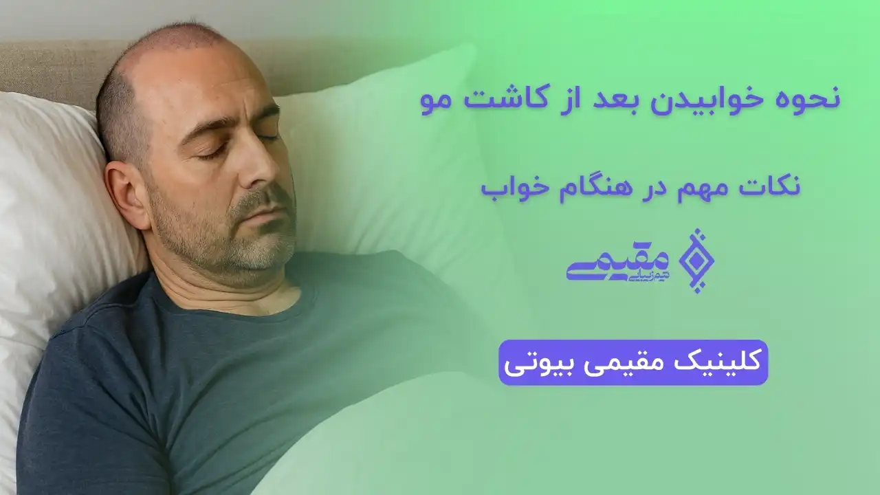 نحوه خوابیدن بعد از کاشت مو