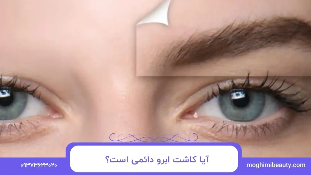 مراحل کاشت ابرو