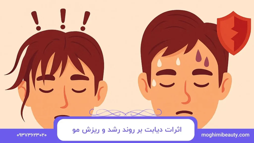 اثرات دیابت بر روند رشد و ریزش مو