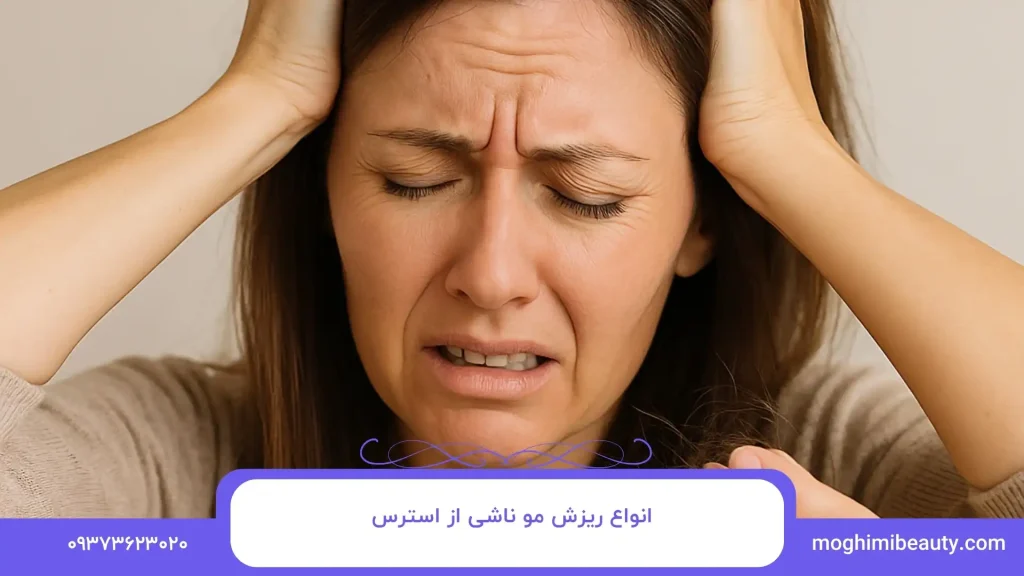 انواع ریزش مو ناشی از استرس