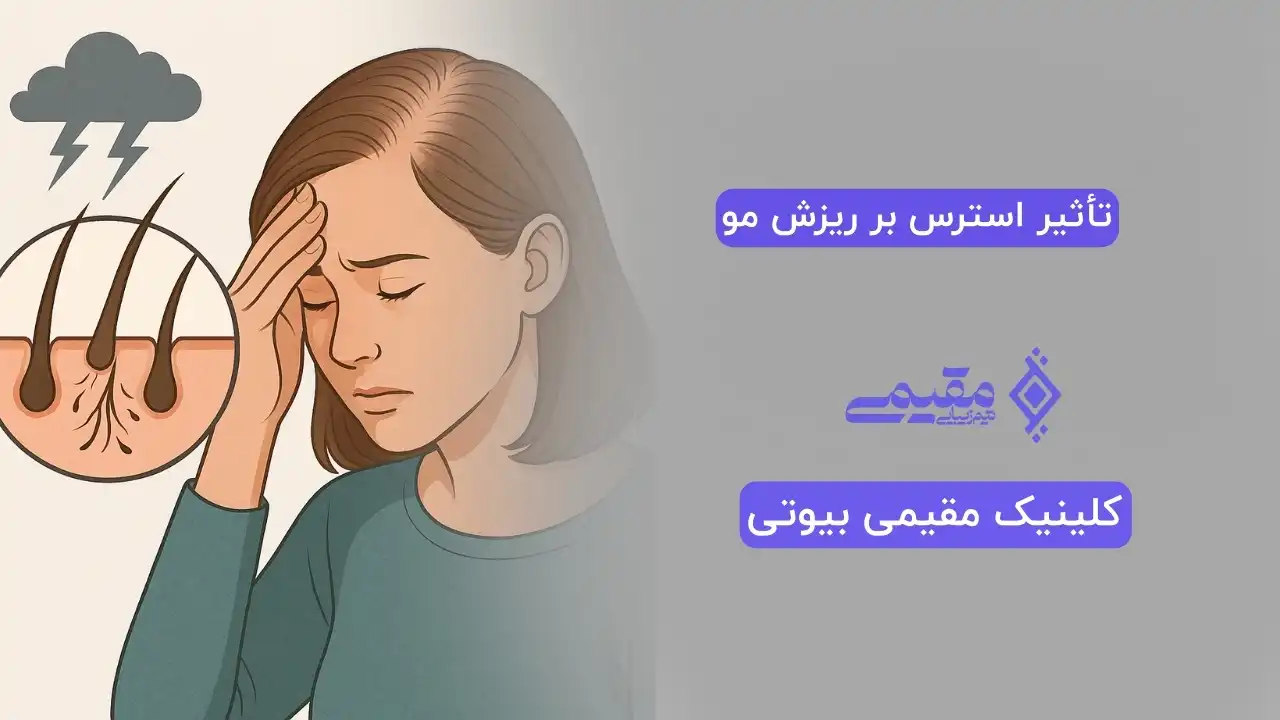 تأثیر استرس بر ریزش مو