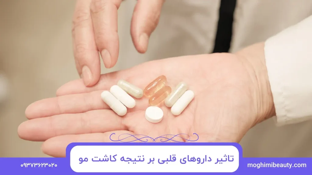 تاثیر داروهای قلبی بر نتیجه کاشت مو