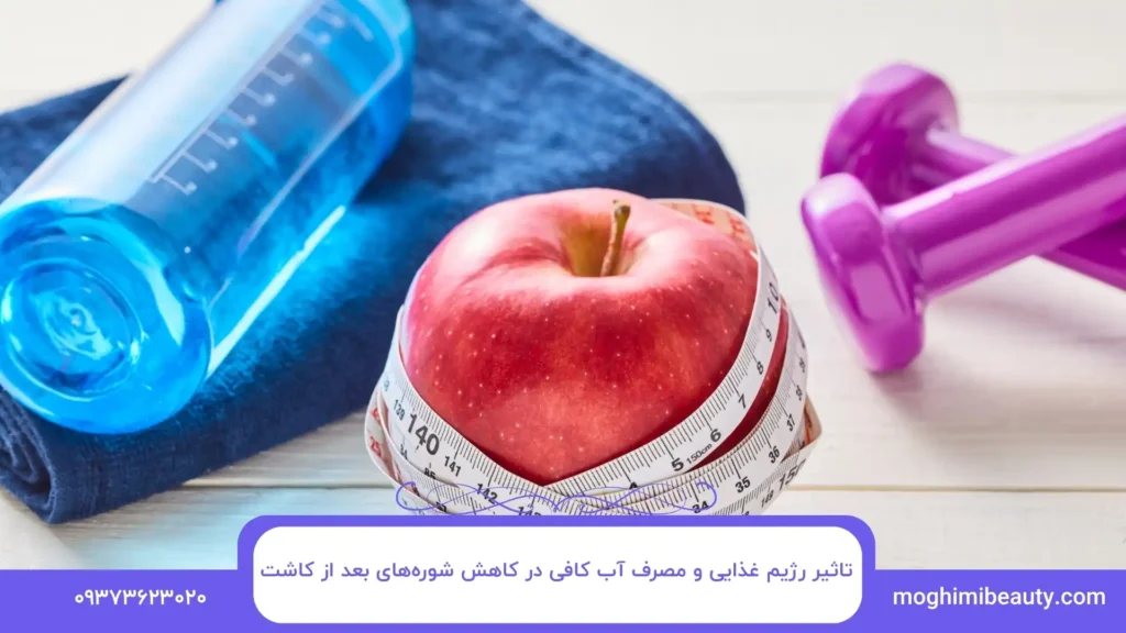 تاثیر رژیم غذایی و مصرف آب کافی در کاهش شوره‌های بعد از کاشت