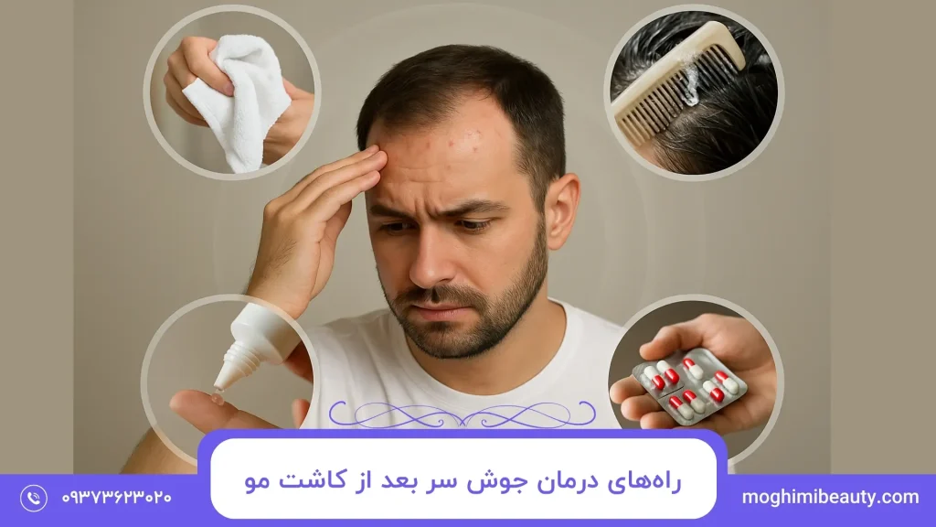 راه‌های درمان جوش سر بعد از کاشت مو