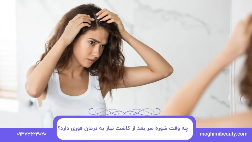 چه وقت شوره سر بعد از کاشت نیاز به درمان فوری دارد؟