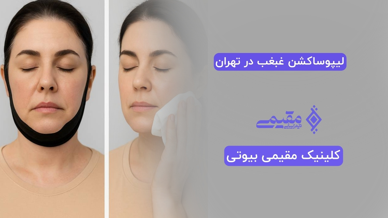 لیپوساکشن غبغب در تهران