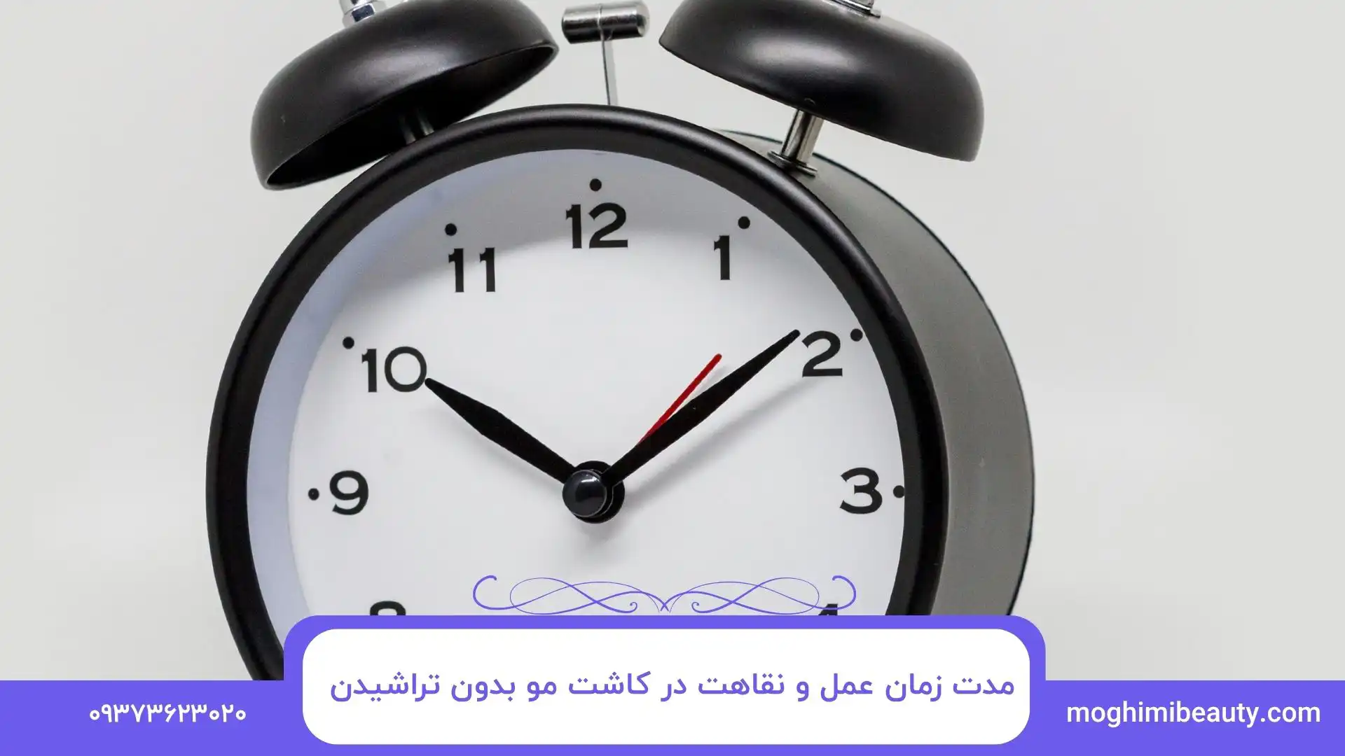 مدت زمان عمل و نقاهت در کاشت مو بدون تراشیدن