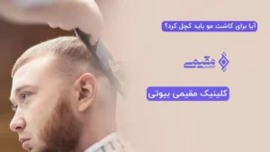 آیا برای کاشت مو باید کچل کرد؟ بررسی کامل کاشت مو با و بدون تراشیدن سر