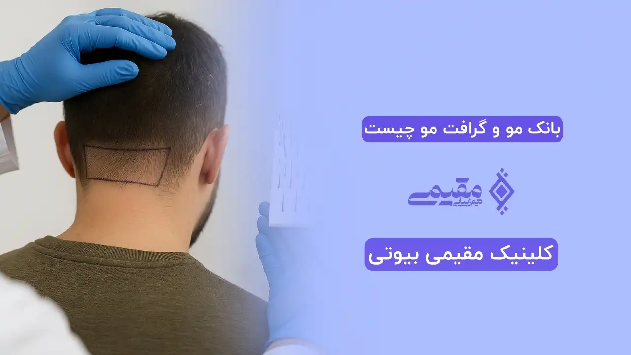 بانک مو و گرافت مو چیست