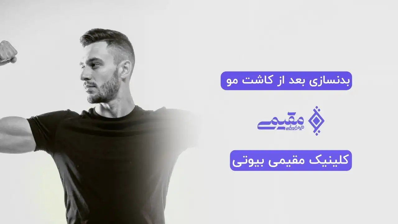 بدنسازی بعد از کاشت مو