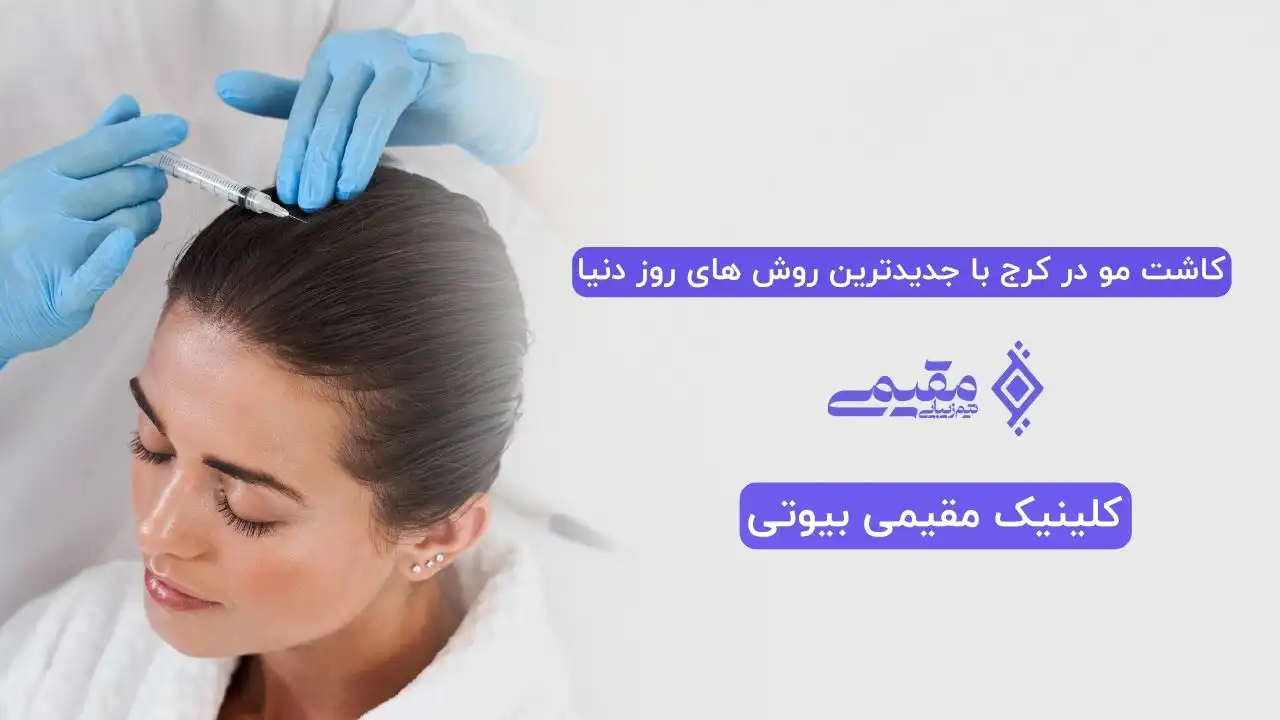 کاشت مو در کرج با جدیدترین روش های روز دنیا
