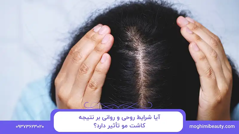 آیا شرایط روحی و روانی بر نتیجه کاشت مو تأثیر دارد؟