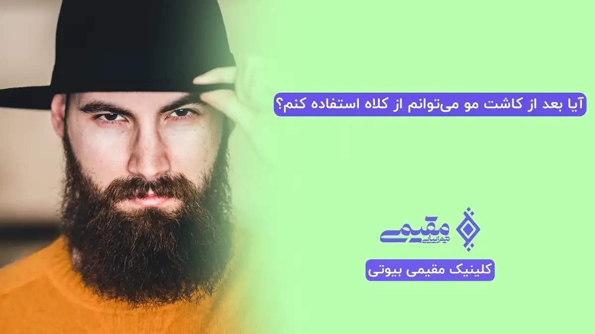 آیا بعد از کاشت مو می‌توانم از کلاه استفاده کنم؟