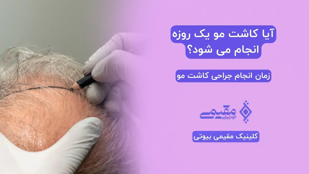 آیا کاشت مو یک روزه انجام می شود؟ نتایج کاشت مو یکروزه ⭐