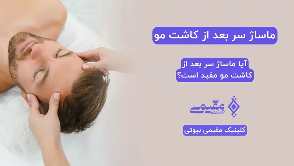 ماساژ سر بعد از کاشت مو | فواید ماساژ سر بعد از کاشت مو ⭐