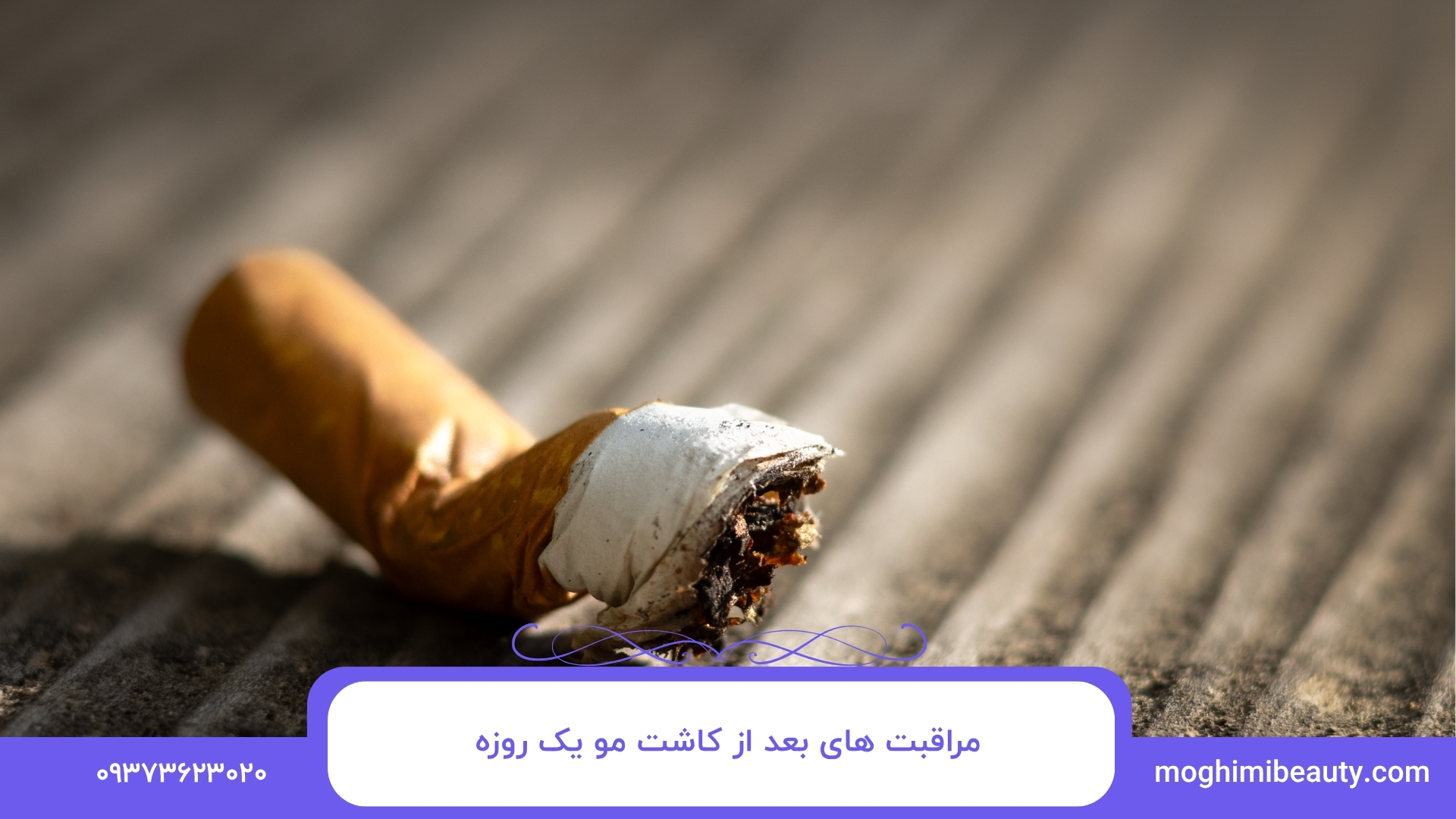 مراقبت های بعد از کاشت مو یک روزه